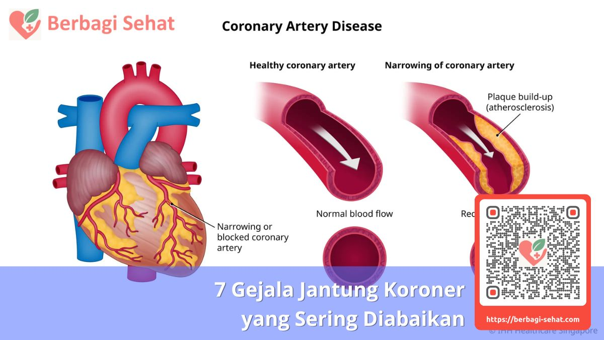 7 Gejala Jantung Koroner yang Sering Diabaikan 2 7 Gejala yang Sering Diabaikan