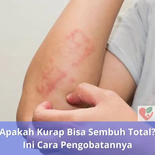 Apakah Kurap Bisa Sembuh Total Ini Cara Pengobatannya