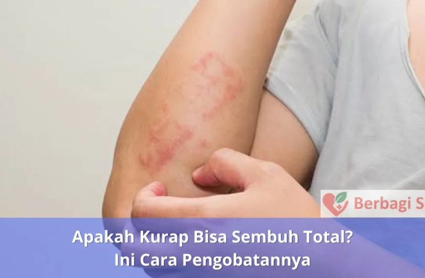 Apakah Kurap Bisa Sembuh Total Ini Cara Pengobatannya