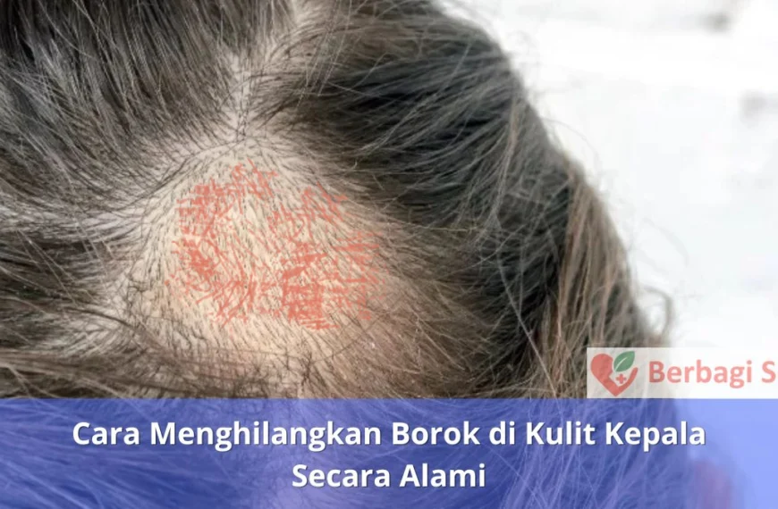 Cara Menghilangkan Borok di Kulit Kepala Secara Alami