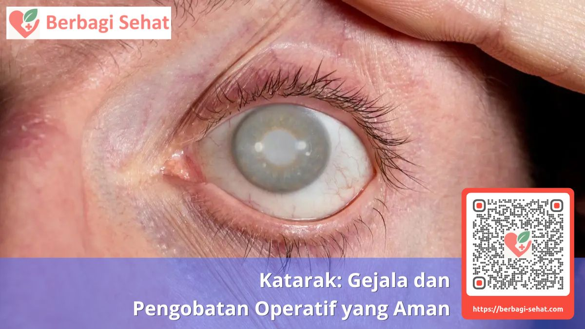 Katarak: Gejala dan Pengobatan Operatif yang Aman 1 Katarak Gejala dan Pengobatan Operatif yang Aman - operasi katarak