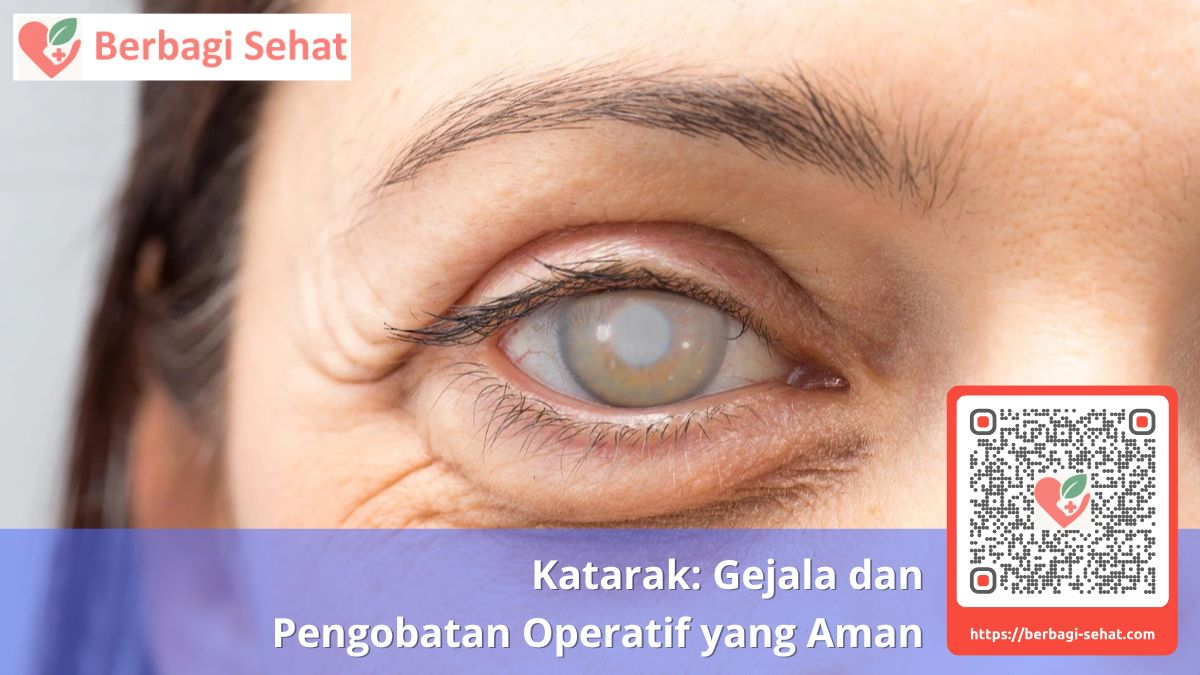 Katarak: Gejala dan Pengobatan Operatif yang Aman 2 Katarak Gejala dan Pengobatan Operatif yang Aman - penyebab katarak