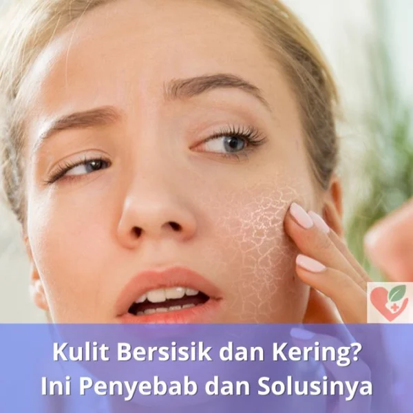Kulit Bersisik dan Kering Ini Penyebab dan Solusinya