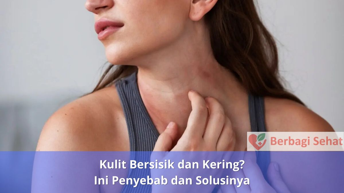 Kulit Bersisik dan Kering? Ini Penyebab dan Solusinya 2 Kulit Bersisik dan Kering Ini Penyebab dan Solusinya Faktor Lingkungan
