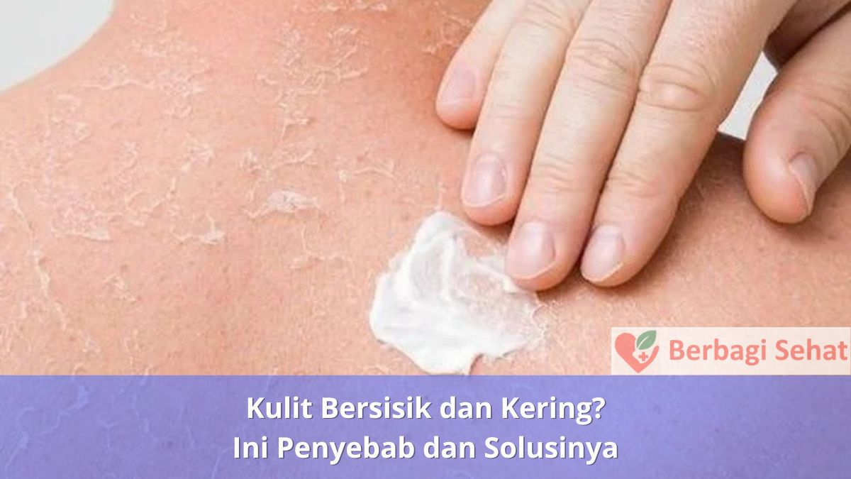 Kulit Bersisik dan Kering? Ini Penyebab dan Solusinya 3 Kulit Bersisik dan Kering Ini Penyebab dan Solusinya Salep