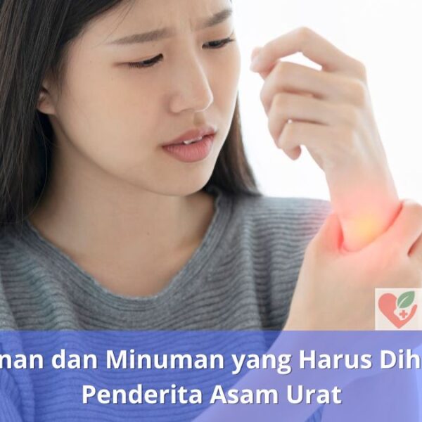 Makanan dan Minuman yang Harus Dihindari Penderita Asam Urat