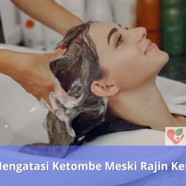 Tips Mengatasi Ketombe Meski Rajin Keramas