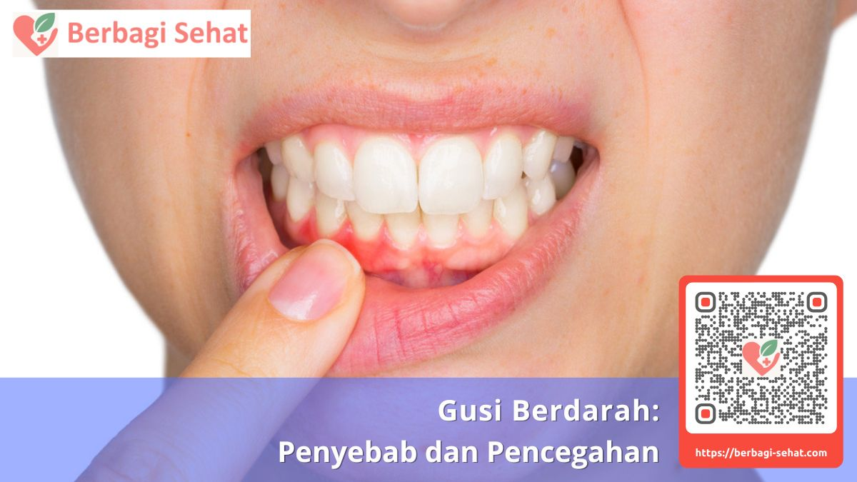 Gusi Berdarah: Penyebab dan Pencegahan 2 gusi bengkak dan berdarah