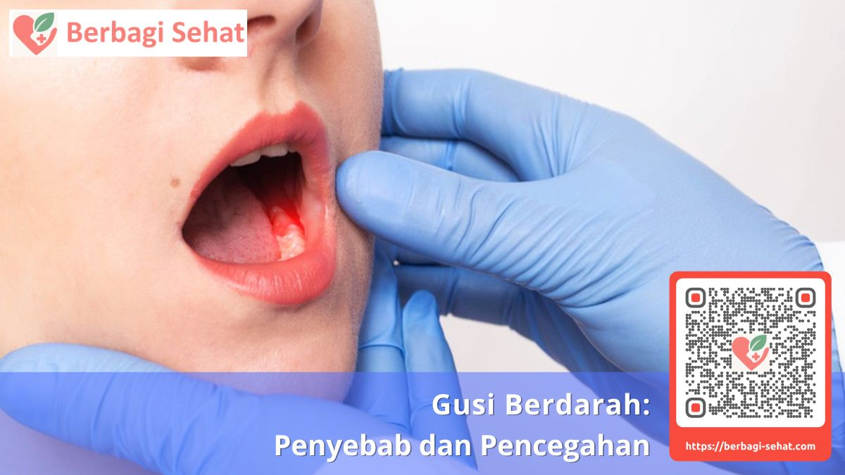 Gusi Berdarah: Penyebab dan Pencegahan 4 gusi berdarah kurang vitamin apa