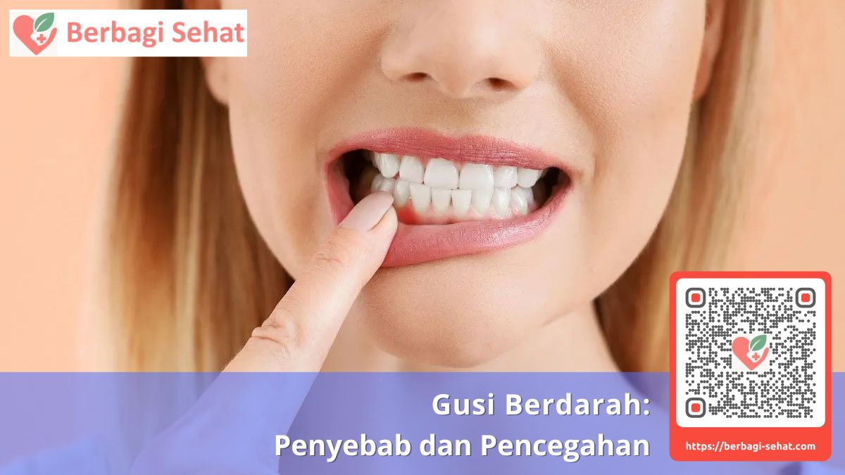 Gusi Berdarah: Penyebab dan Pencegahan 1 gusi sering berdarah