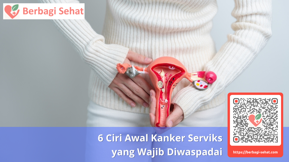 6 Ciri Awal Kanker Serviks yang Wajib Diwaspadai 2 6 Ciri Awal Kanker Serviks yang Sering Diabaikan