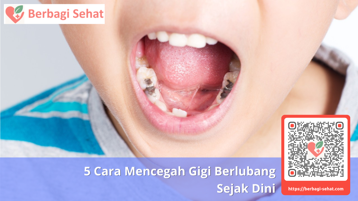5 Cara Mencegah Gigi Berlubang Sejak Dini 1 Bagaimana Sih Gigi Bisa Berlubang