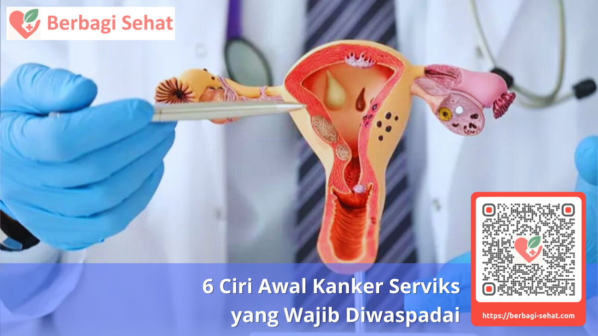6 Ciri Awal Kanker Serviks yang Wajib Diwaspadai 1 Memahami Kanker Serviks Apa yang Sebenarnya Terjadi