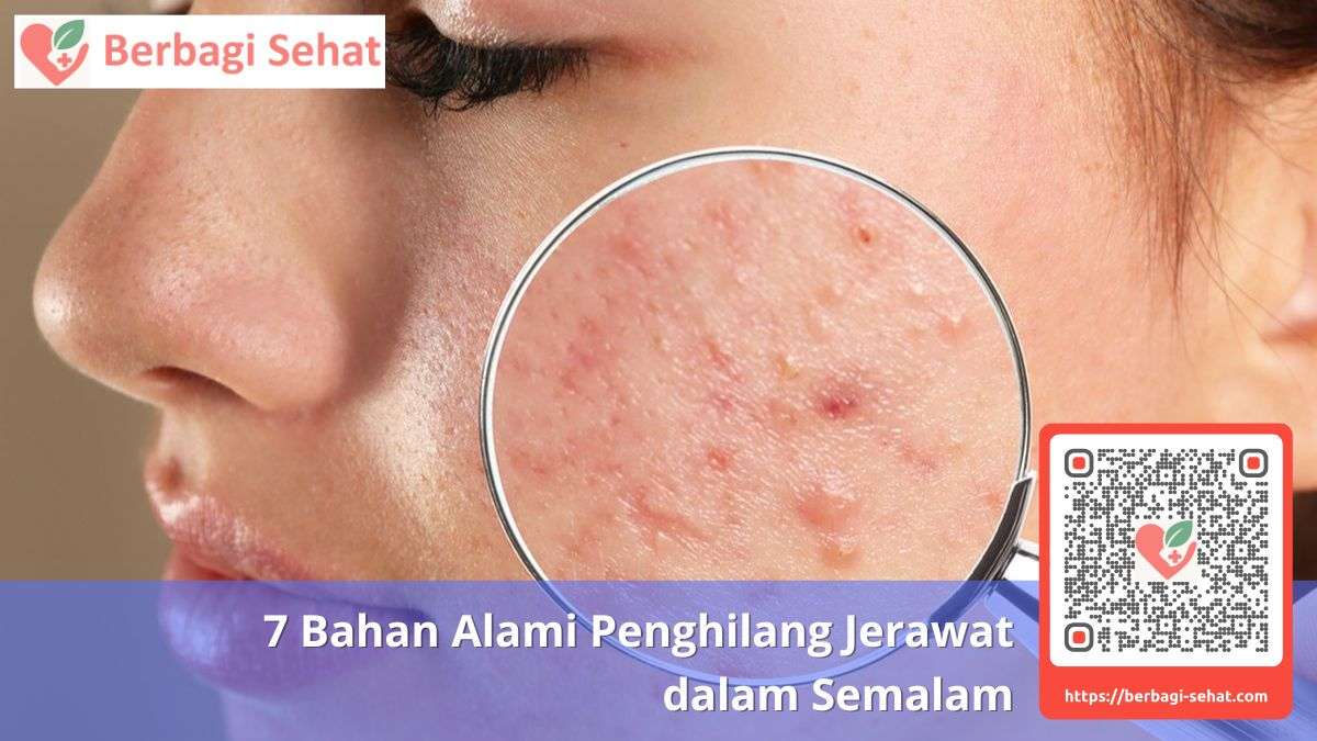 7 Bahan Alami Penghilang Jerawat 2 Memahami Penyebab Jerawat