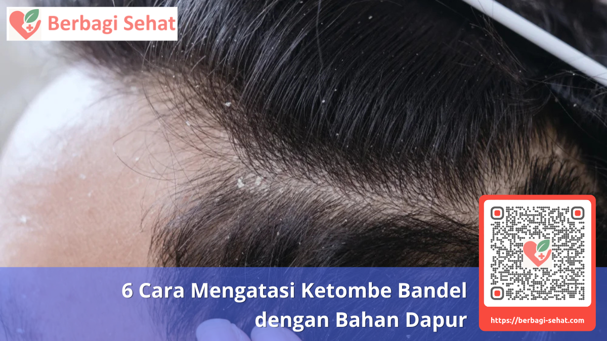 6 Cara Mengatasi Ketombe Bandel dengan Bahan Dapur 1 Memahami Penyebab Ketombe