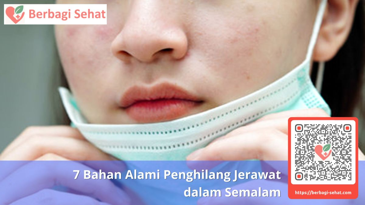 7 Bahan Alami Penghilang Jerawat 5 Pencegahan dan Kontraindikasi Jerawat