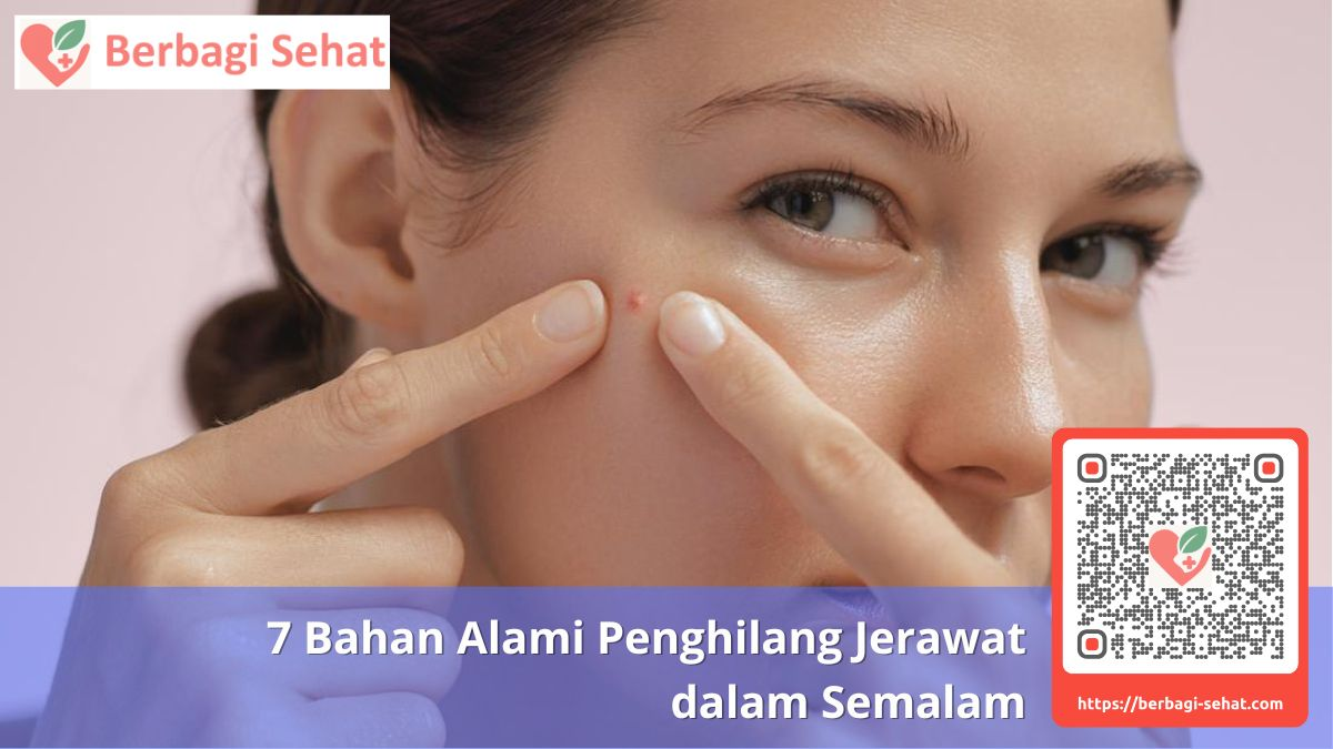 7 Bahan Alami Penghilang Jerawat 6 Tips Pencegahan Jerawat Harian