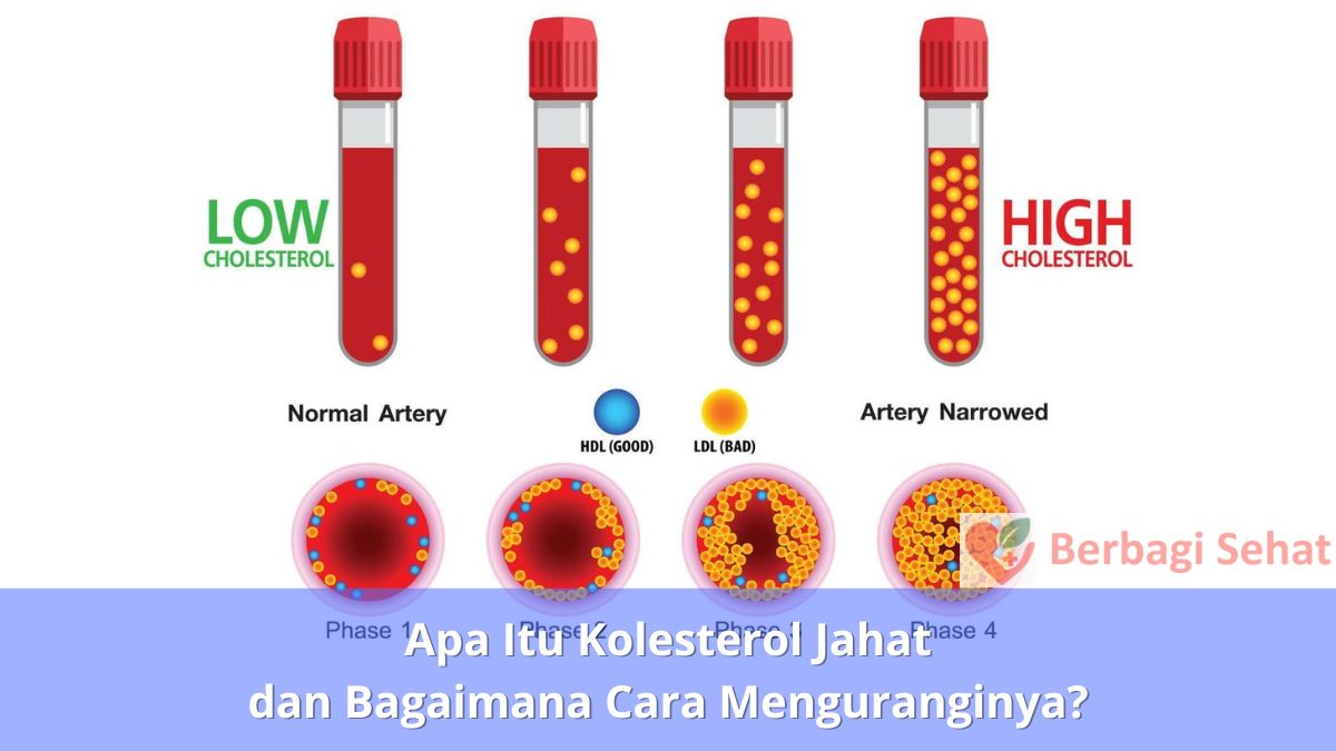 Apa Itu Kolesterol Jahat dan Bagaimana Cara Menguranginya Ldl vs Hdl