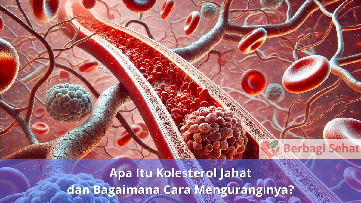 Apa Itu Kolesterol Jahat dan Bagaimana Cara Menguranginya