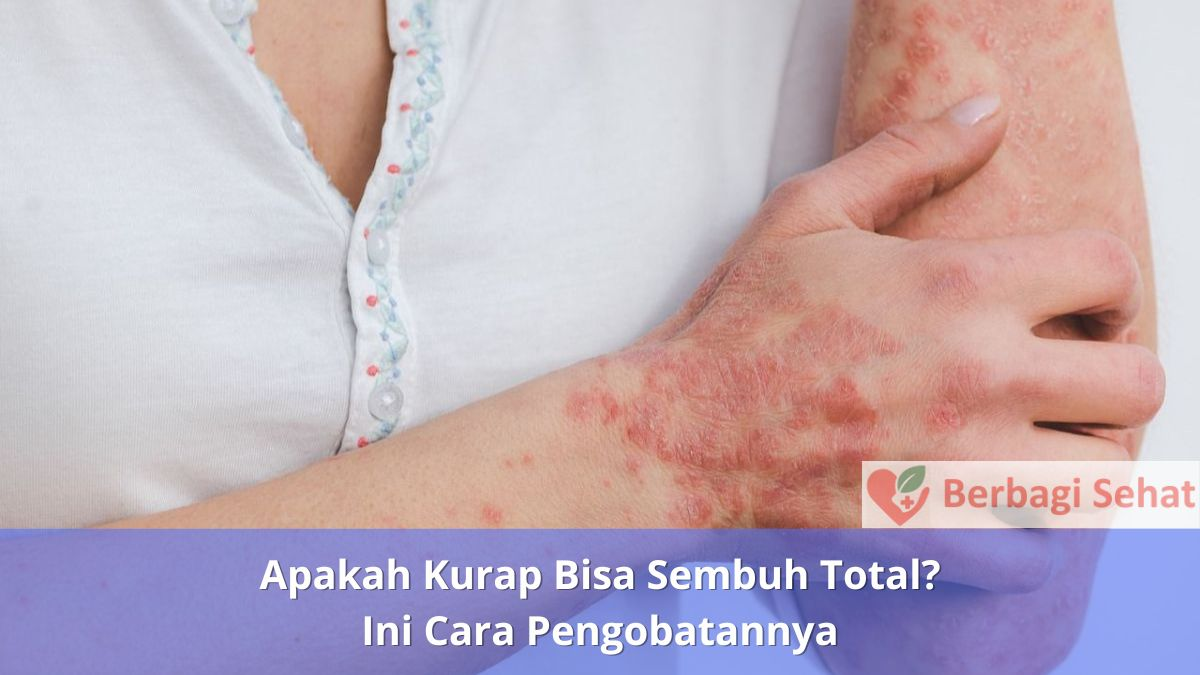 Apakah Kurap Bisa Sembuh Total Ini Cara Pengobatannya Ciri ciri Kurap
