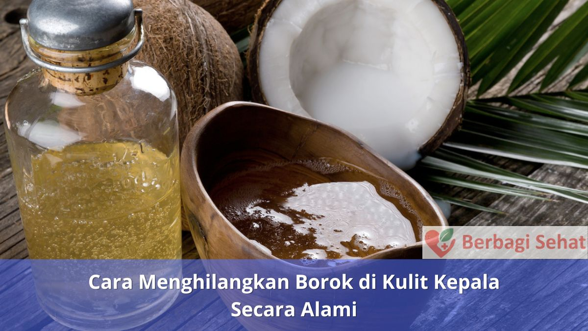 Cara Menghilangkan Borok di Kulit Kepala Secara Alami Minyak Kelapa