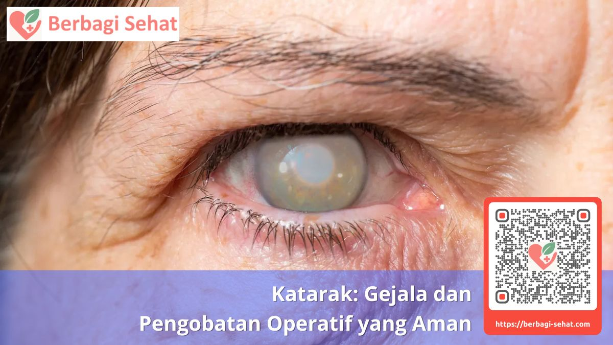 Katarak Gejala dan Pengobatan Operatif yang Aman