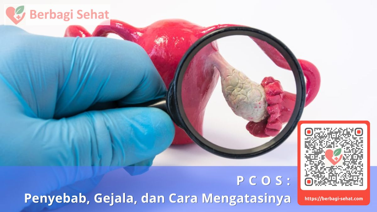 PCOS Penyebab Gejala dan Cara Mengatasinya penyebab pcos pada wanita