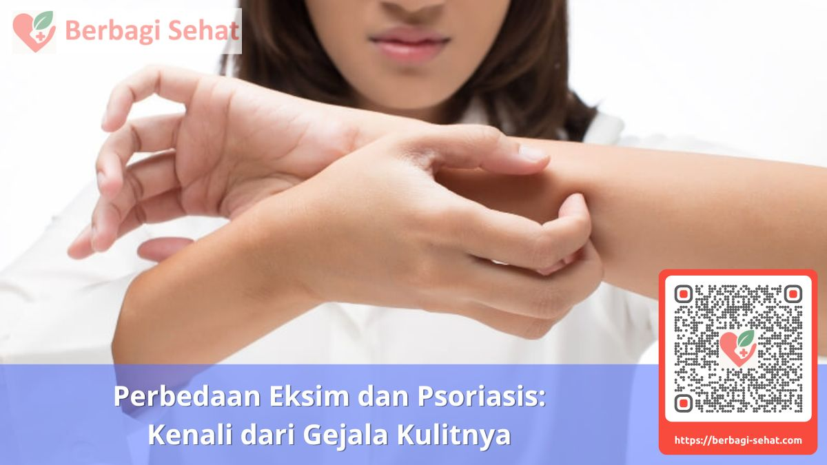 Perbedaan Eksim dan Psoriasis Kenali dari Gejala Kulitnya Penyebab Eksim