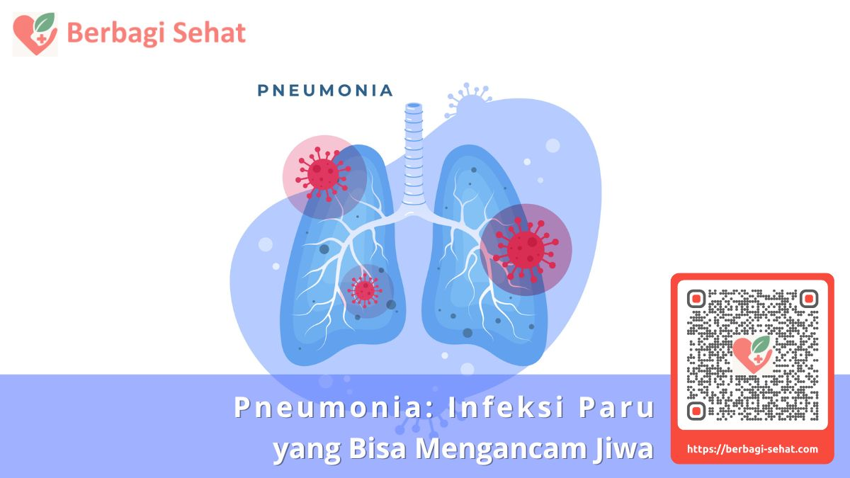 Pneumonia Infeksi Paru yang Bisa Mengancam Jiwa - Ciri Pneumonia