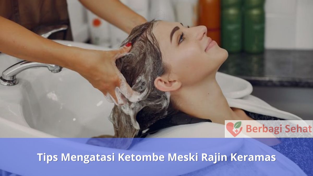 Tips Mengatasi Ketombe Meski Rajin Keramas