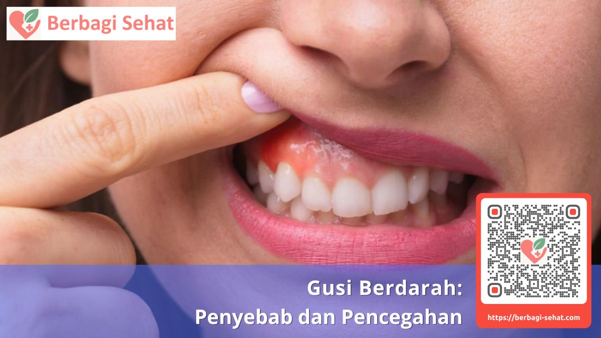 gusi berdarah saat sikat gigi