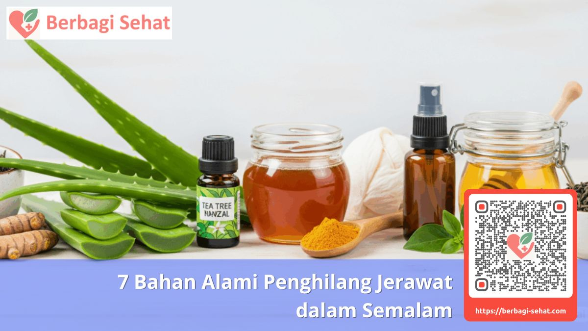 7 Bahan Alami Ampuh Hilangkan Jerawat