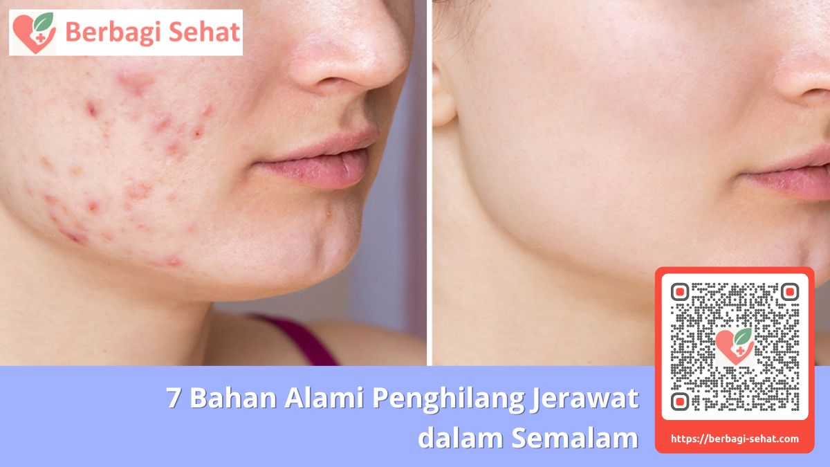 Ekspektasi Realistis vs Kenyataan Jerawat